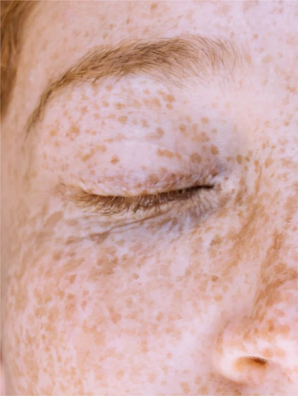 Siero alla vitamina C