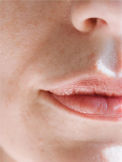 Moisturizing Cream for Sensitive Skin